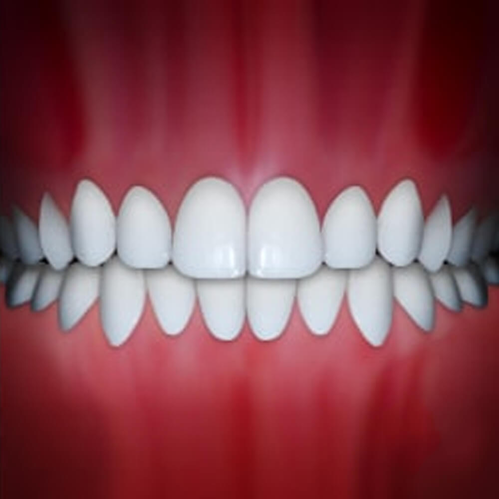 Perfect white teeth aligned in bite position against red gum background showing orthodontic results.