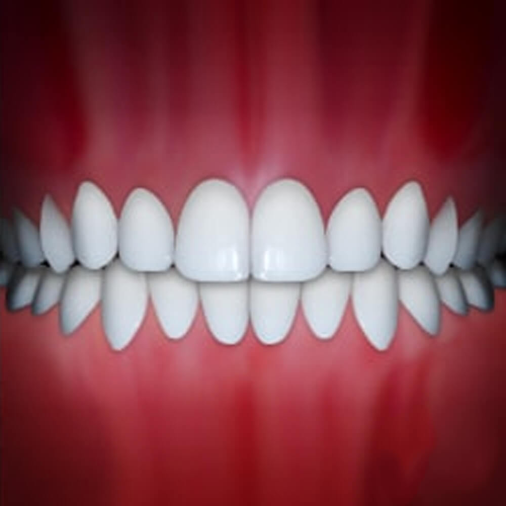 Perfect white teeth alignment displayed against pink gum background for orthodontic reference.