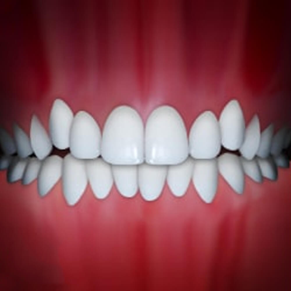Perfect white teeth alignment displayed against red gum background, showcasing orthodontic results.