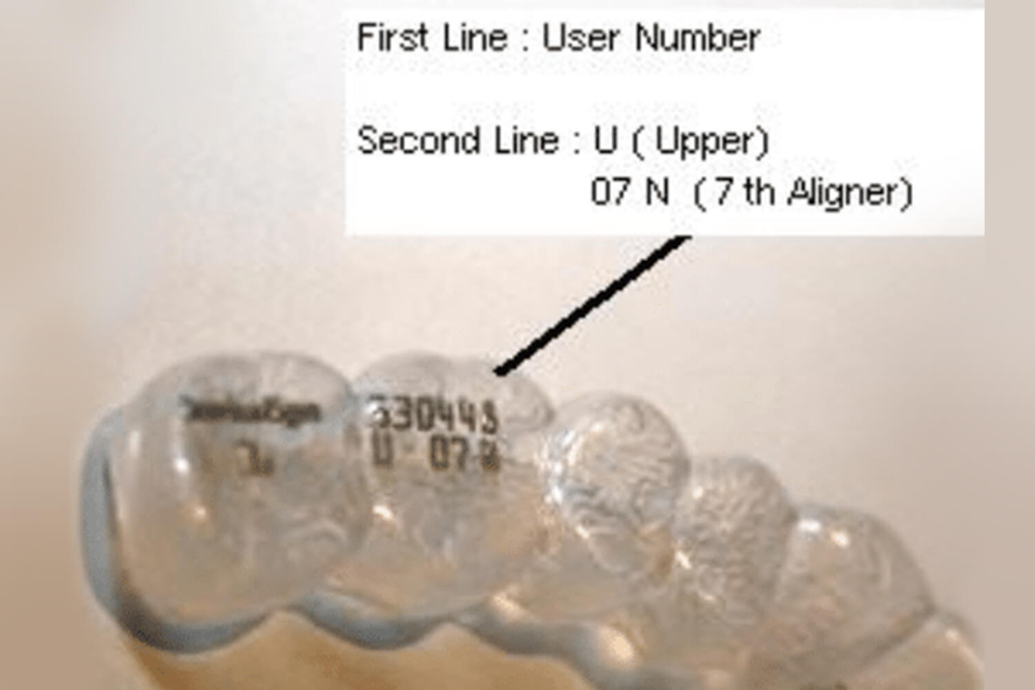 Close-up of orthodontic bracket with labeled diagram showing user number and upper arch designation markings.