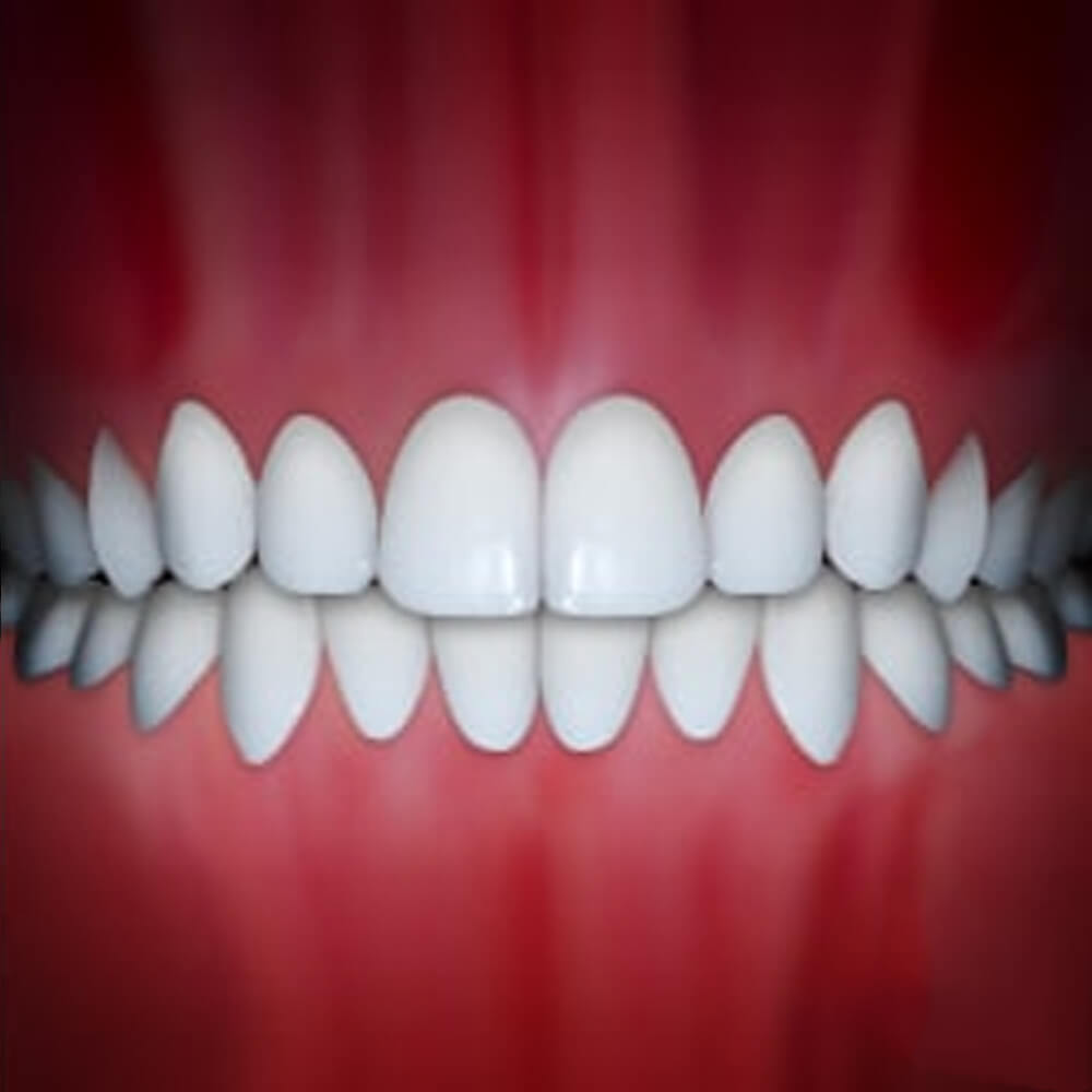 Perfect white teeth aligned in ideal bite against red gum background, dental display.