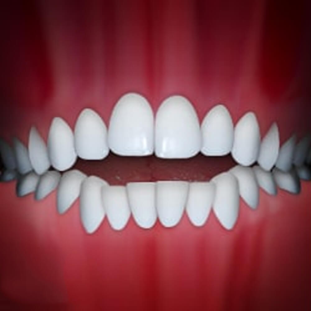 Perfect white teeth aligned in upper and lower rows against red gum background.
