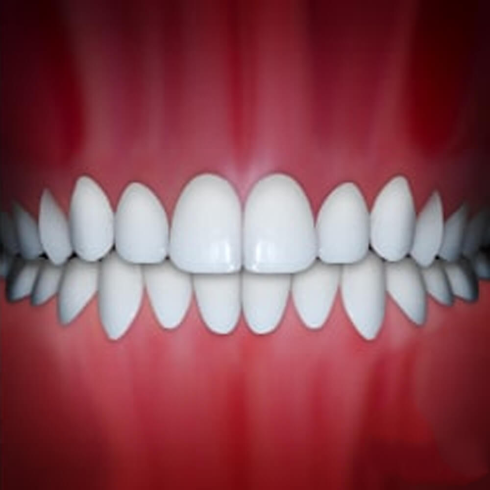 Perfect white teeth alignment displayed against red gum background in dental illustration.