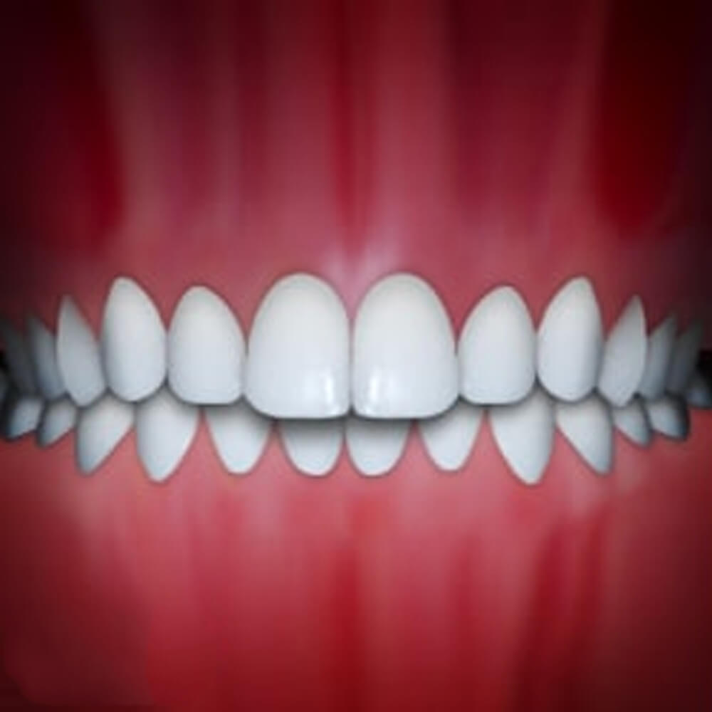 Perfect white teeth alignment displayed against pink gum background showing ideal orthodontic results.