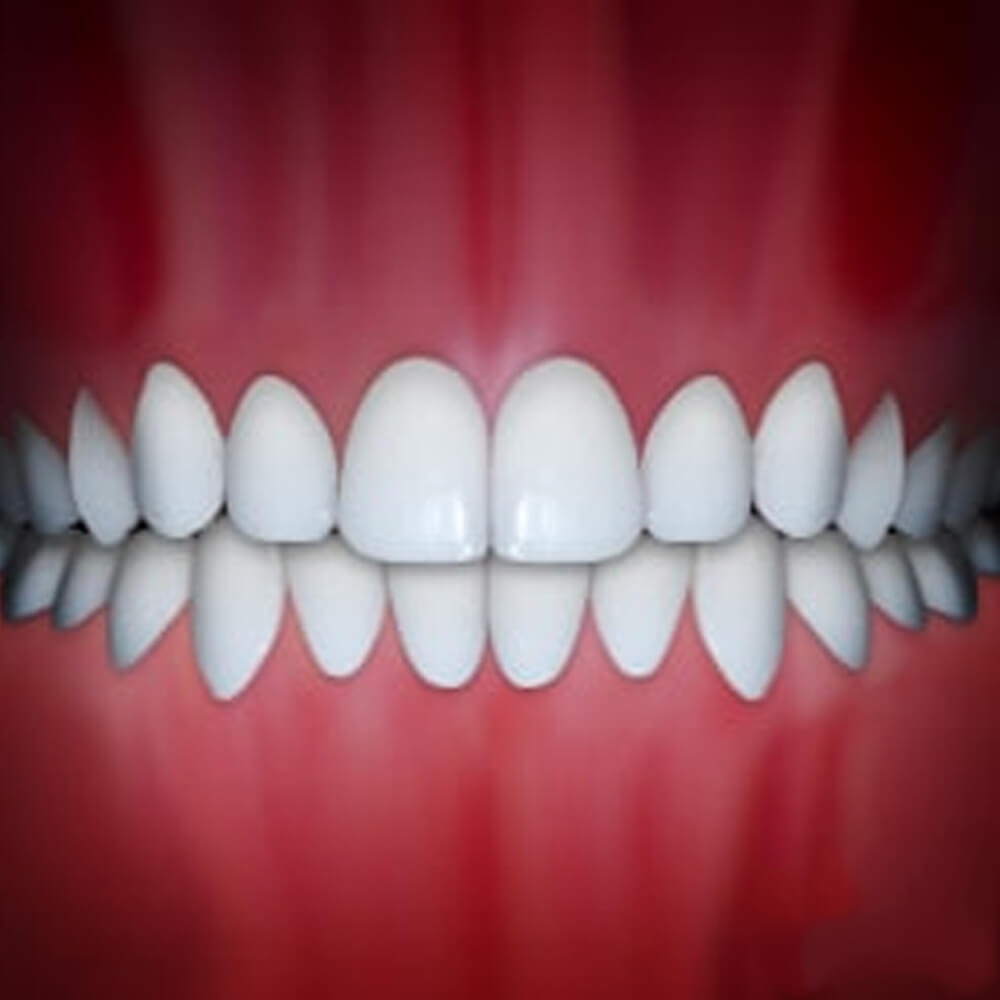 Perfect white teeth smile displayed against red gum background for orthodontic treatment showcase.
