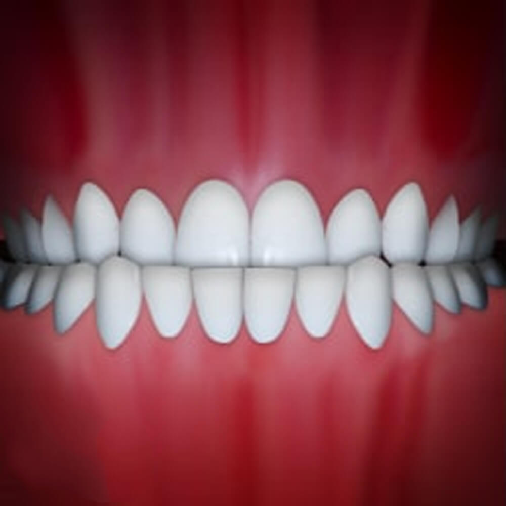 Perfect white teeth aligned in straight rows against pink gum background, demonstrating ideal orthodontic results.