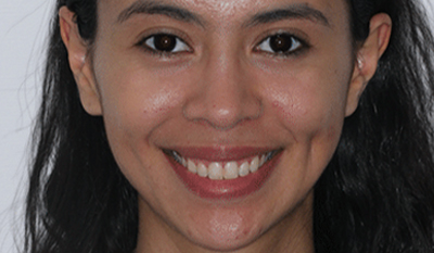Woman smiling at camera showcasing orthodontic results in professional headshot.