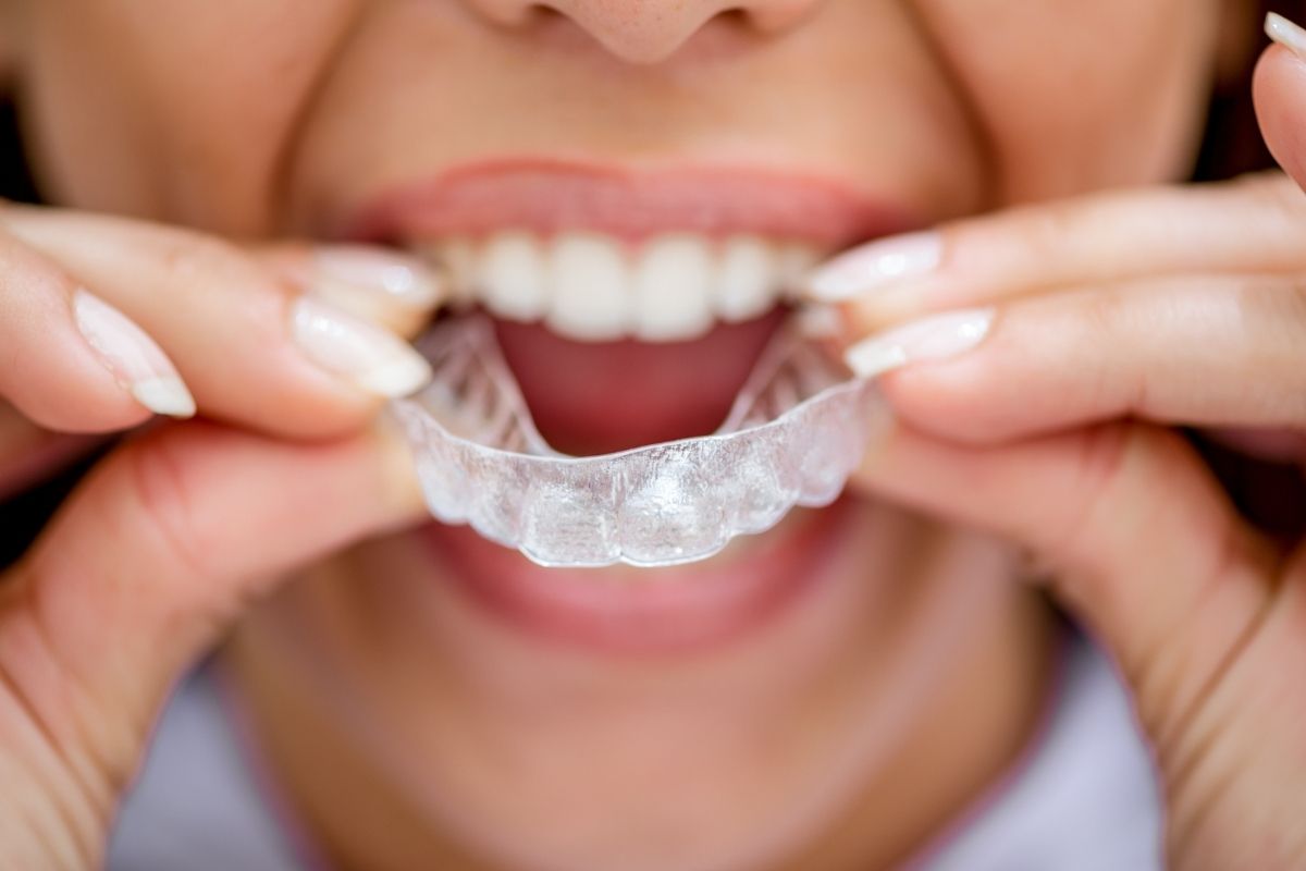 nighttime teeth grinding and invisalign