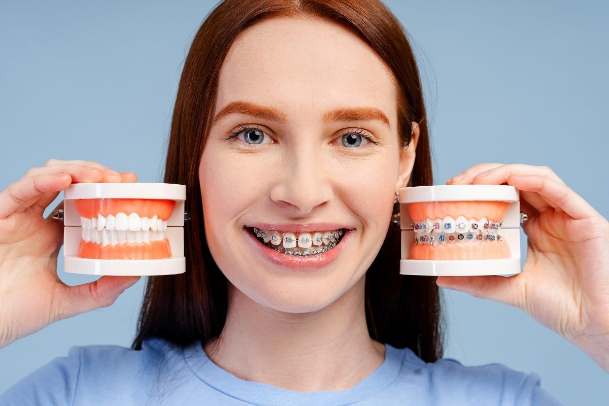 Why Metal Braces Are Considered Safe for Long-Term Use